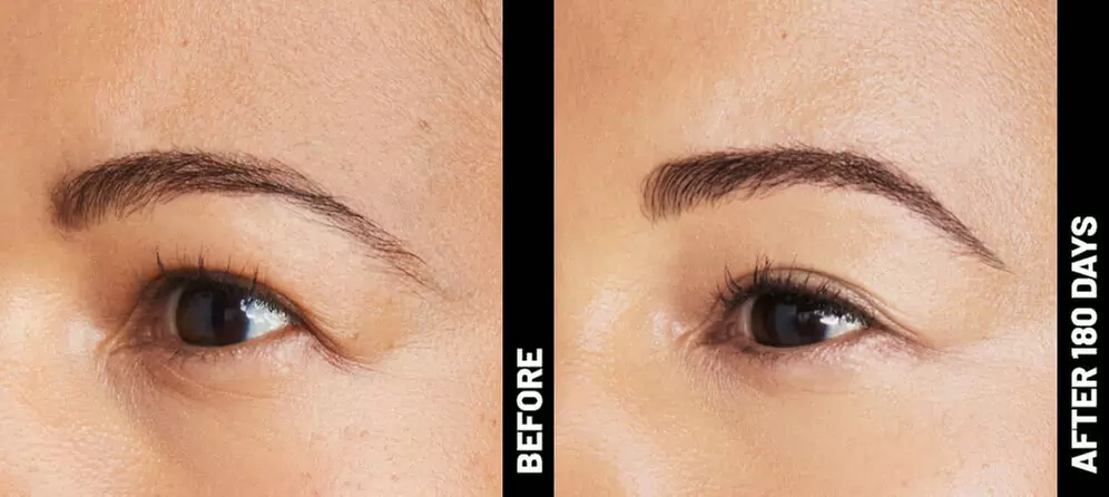 Up to 54% Off on Ultherapy / Ultrasonic Facial at Skin Theory Aesthetics - Primary Image