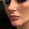 Image 11: Celebrity-Coveted Cheek Pop or Snatched Jawline with PDO Threads at No Pain All Gain Spa (Up to 30% Off)
