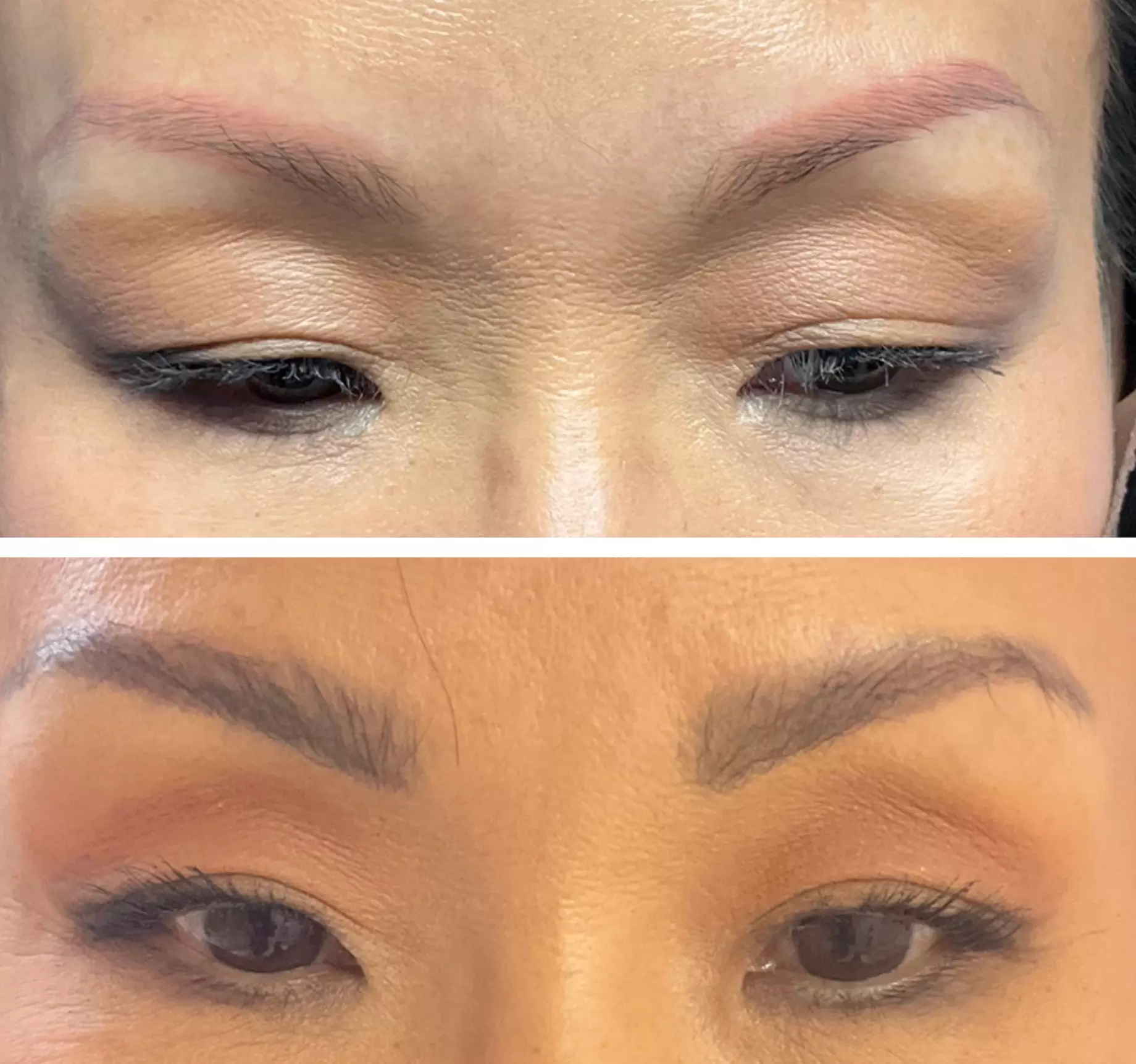 52% off Eyebrow tattoo removal at The Mbar Medspa