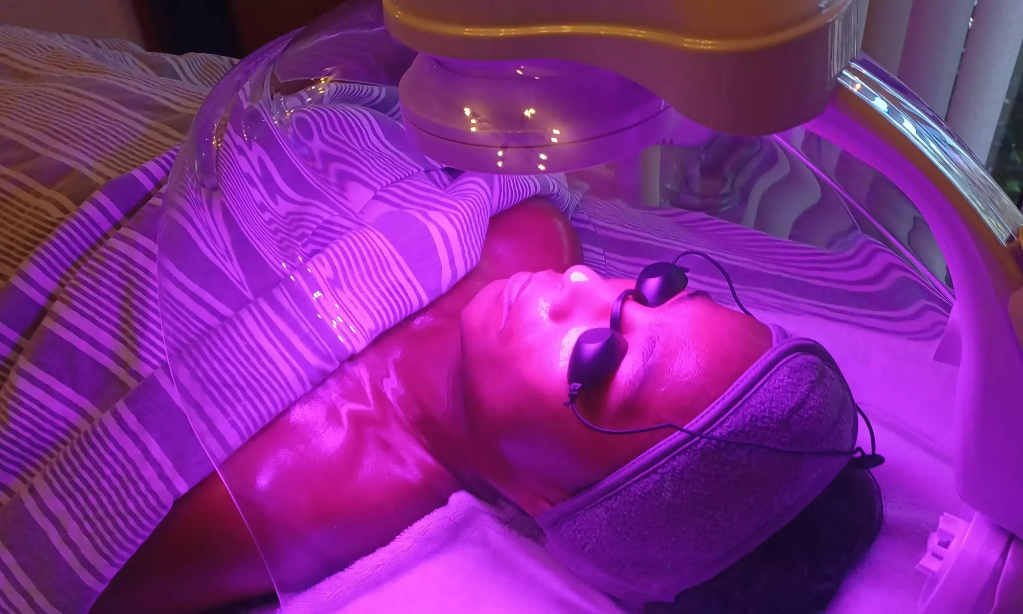 Up to 44% Off on Facial - Oxygen at BARE Skin and Brows - Primary Image
