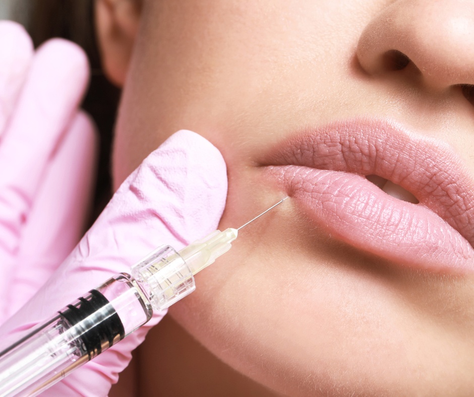 Plump Up Your Lips with 1ml Syringe of Juvéderm Ultra Plus XC at Neurostrive Hydration & Med Spa (Up to 30% Off)