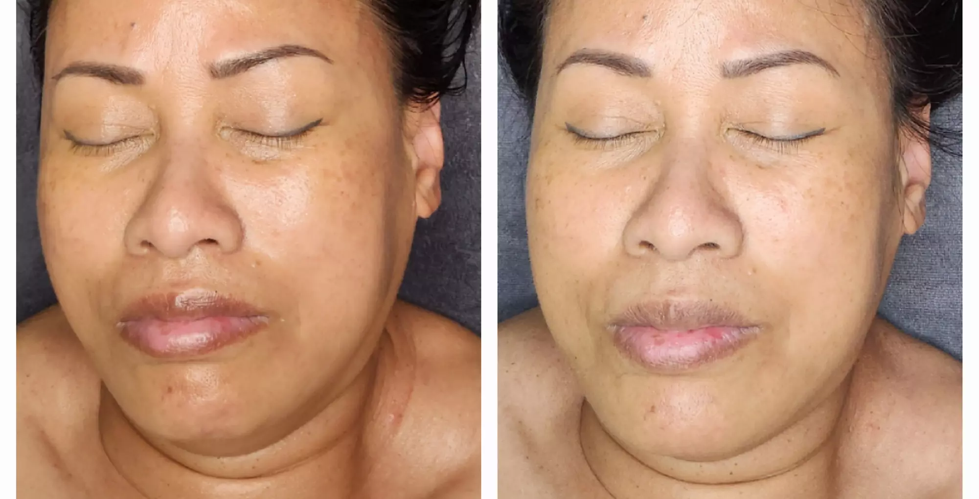 90-Minute Turn Back the Clock Enzyme Facial at Appealing Peels Day Spa - Up to 30% Off  - Primary Image