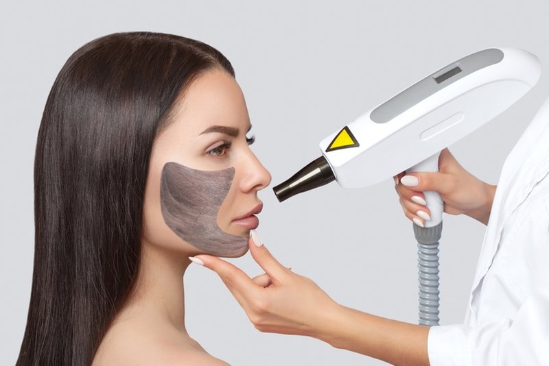 Hollywood peeling for acne and oily skin rejuvenation