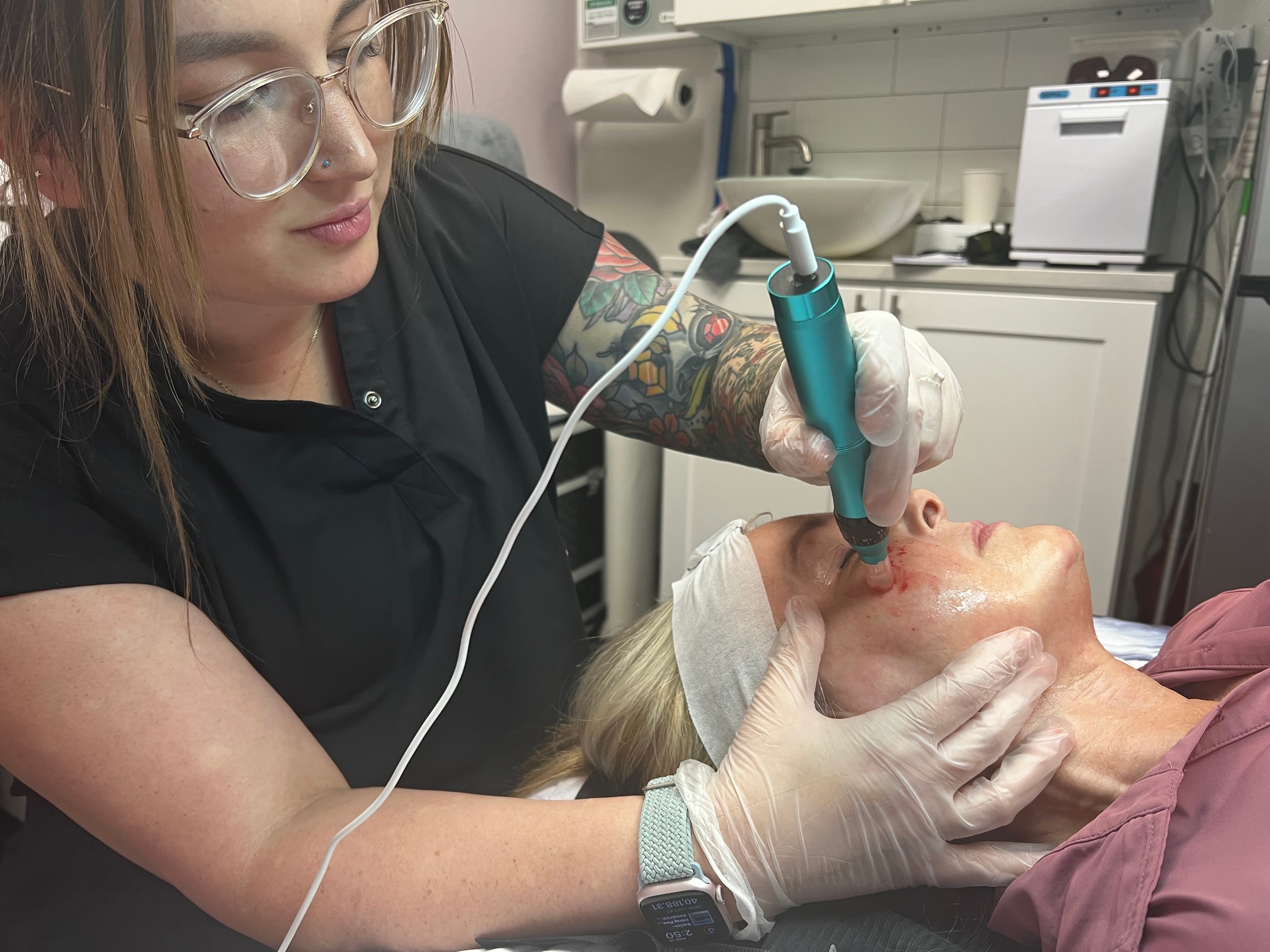 At SculptorRx Medspa, choose from one or three PRP Micro-Needling Facial Treatments with up to 60% off