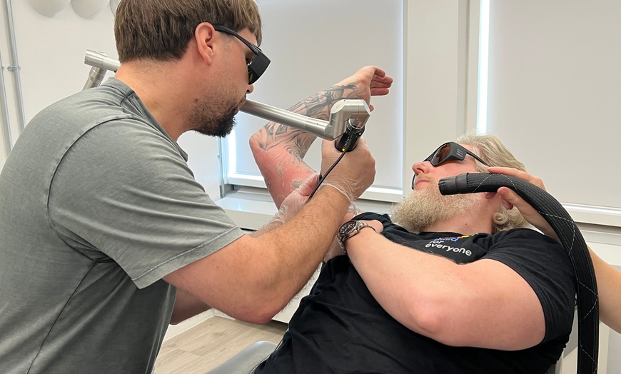 Image 4: Targeted Tattoo Removal – Choose Small, Medium, or Large Area