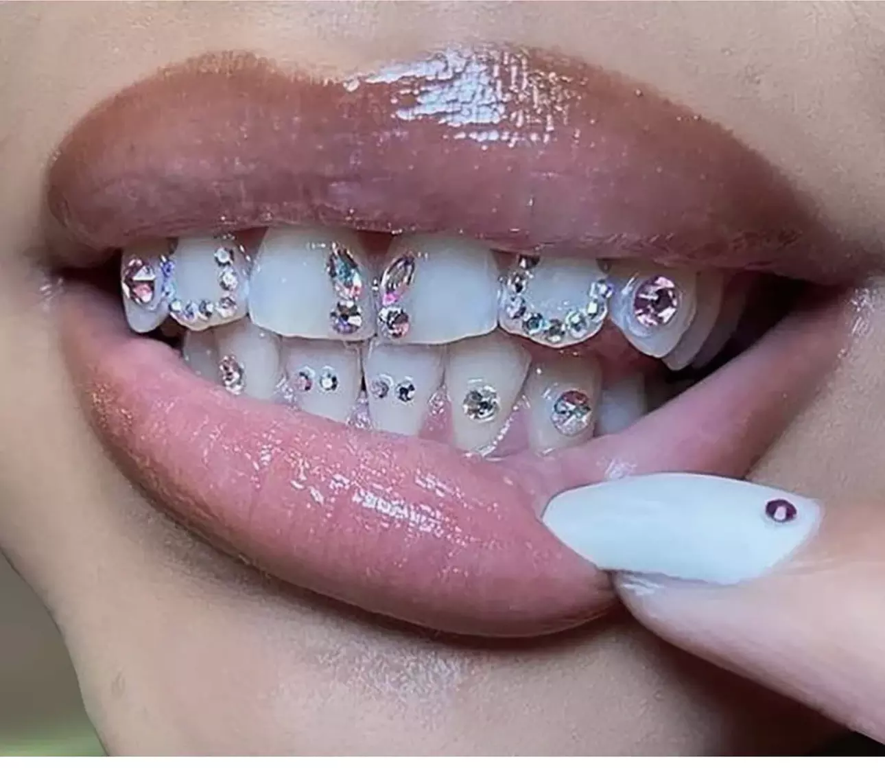 Tsuited Beauty Bar offers dazzling tooth gems and teeth whitening up to 50% off for a brighter smile. - Primary Image