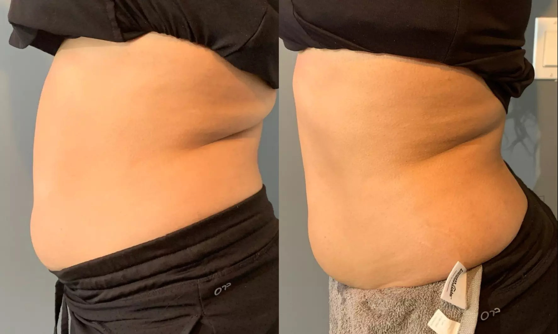 Up to 50% Off on Ultrasonic Fat Reduction at Make Me GorJess - Primary Image