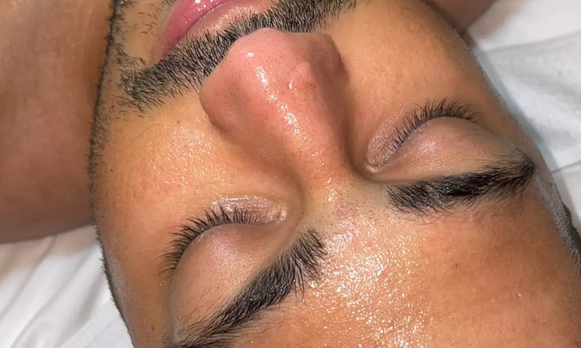 Up to 48% Off on Microdermabrasion at Dk Med Spa Microblading And Academy - Primary Image