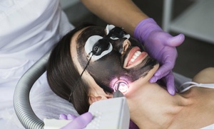 Carbon Laser Peel 