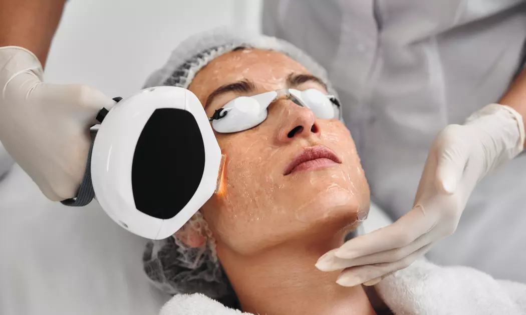 Enjoy 1 or 3 IPL Photo Rejuvenation Treatment with Mask and Vitamin C at Medica Laser Spa (Up To 55% Off) - Primary Image