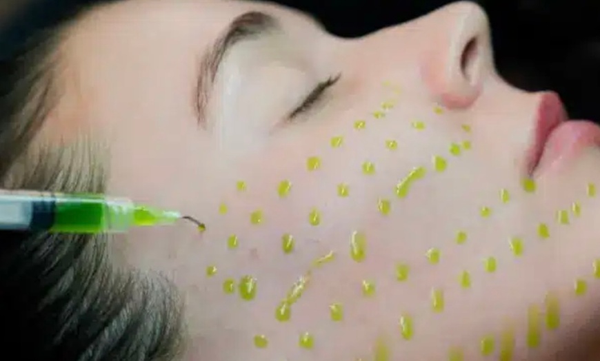 Image 1: BioRePeel for Radiant Skin