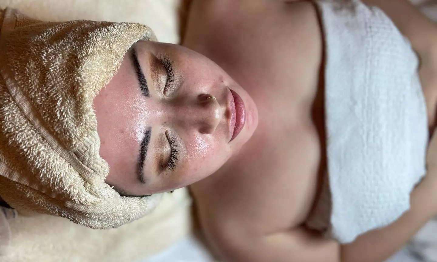 Up to 48% Off on Microdermabrasion at SkinJewells - Primary Image