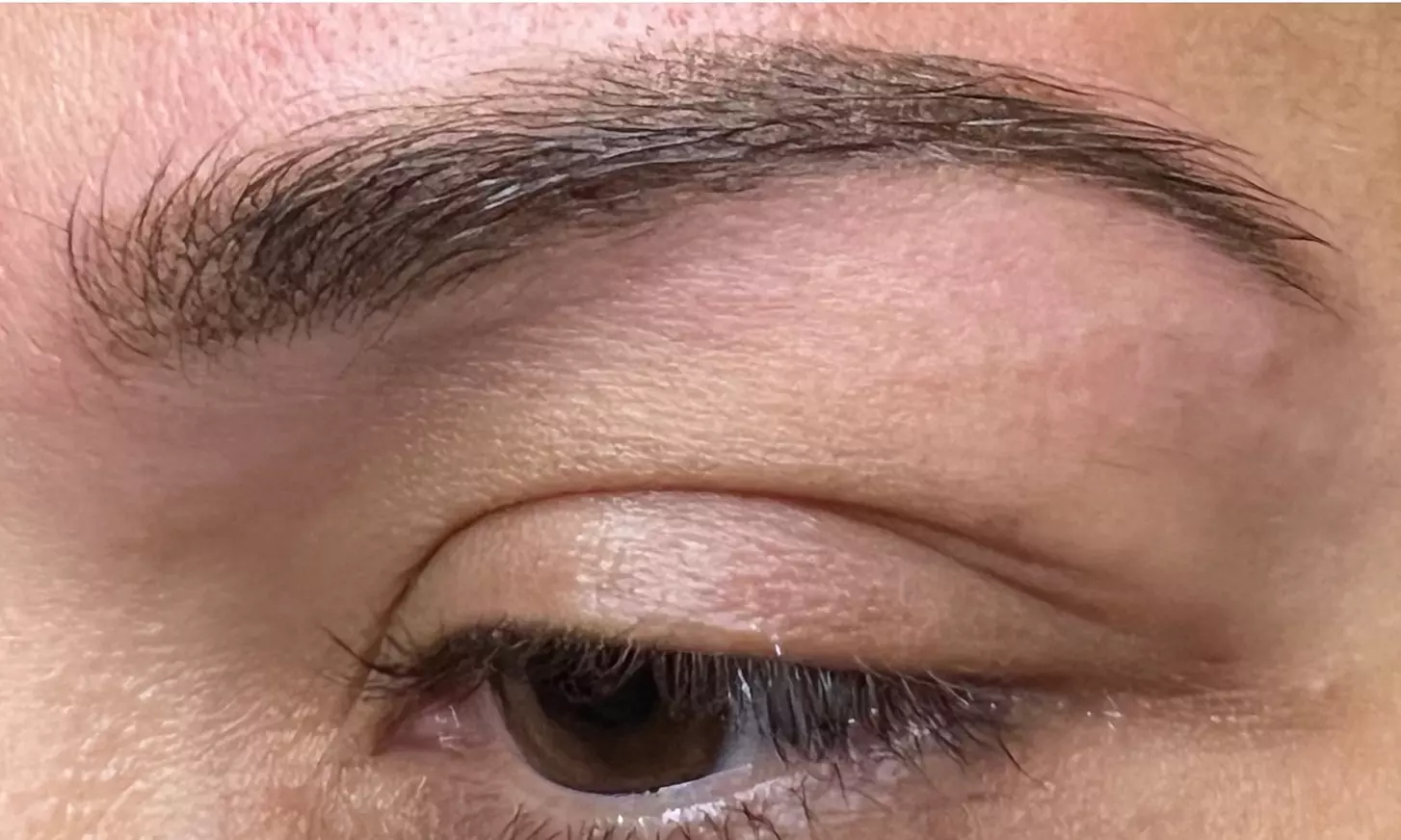 52% off Eyebrow tattoo removal at The Mbar Medspa