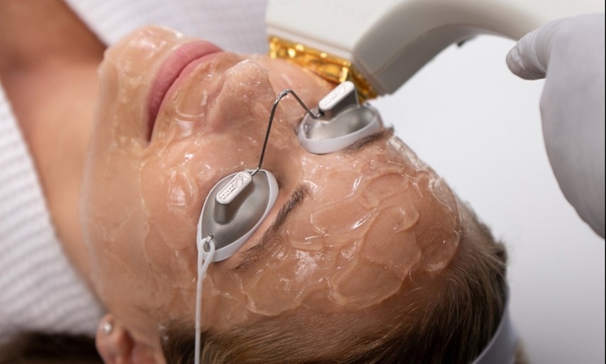 Up to 51% Off on IPL-Intense Pulse Light Therapy at ALux Spa