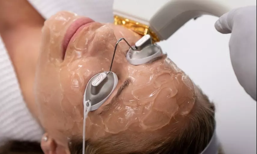 Up to 51% Off on IPL-Intense Pulse Light Therapy at ALux Spa - Primary Image