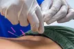 Up to 50% Off on Therapeutic Massage at Precision Physical Therapy - Second Medium