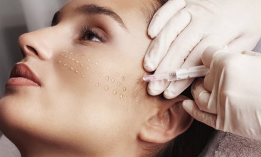 Image 5: Up to 55% Off on Skin Booster  at Amora beauty & health