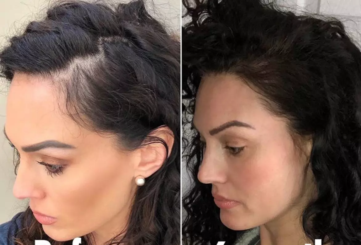 Up to 67% Off on Salon - Hair Straightening Treatment at UK Aesthetics Lounge