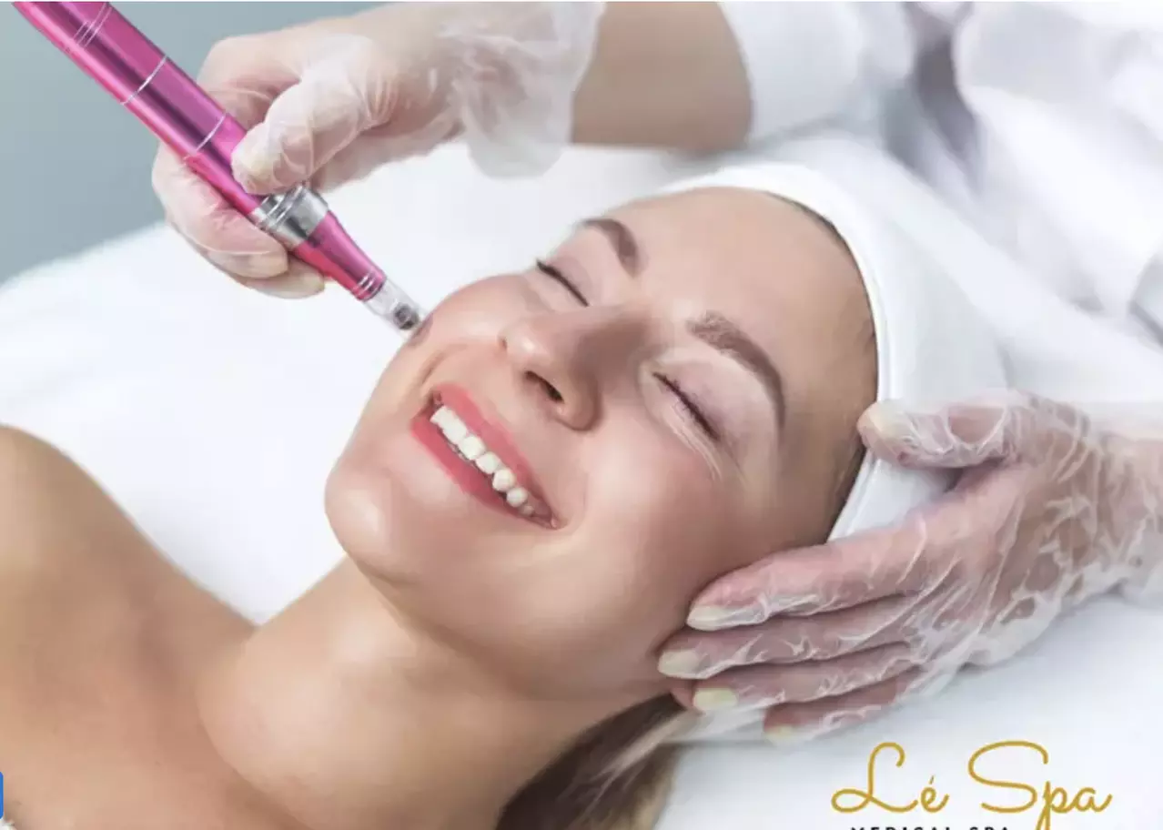 Up to 55% Off on Micro-Needling at Le Spa Medical Spa - Primary Image