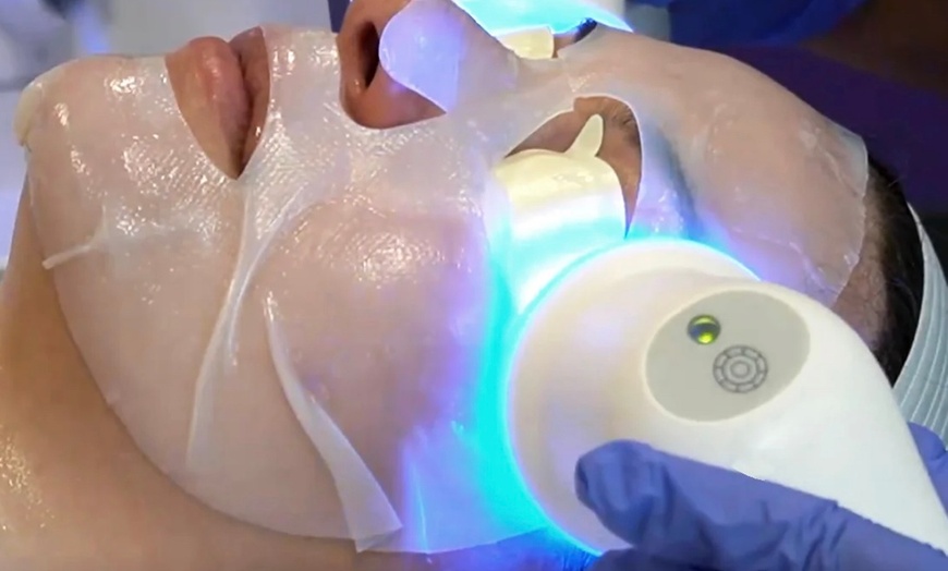 Image 7: Glow with One or Three Glacē™ Skin Treatments