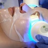 Image 7: Glow with One or Three Glacē™ Skin Treatments