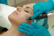 Up To 46% On Microneedling with PRP Facial at Lov Med Spa - Second Medium