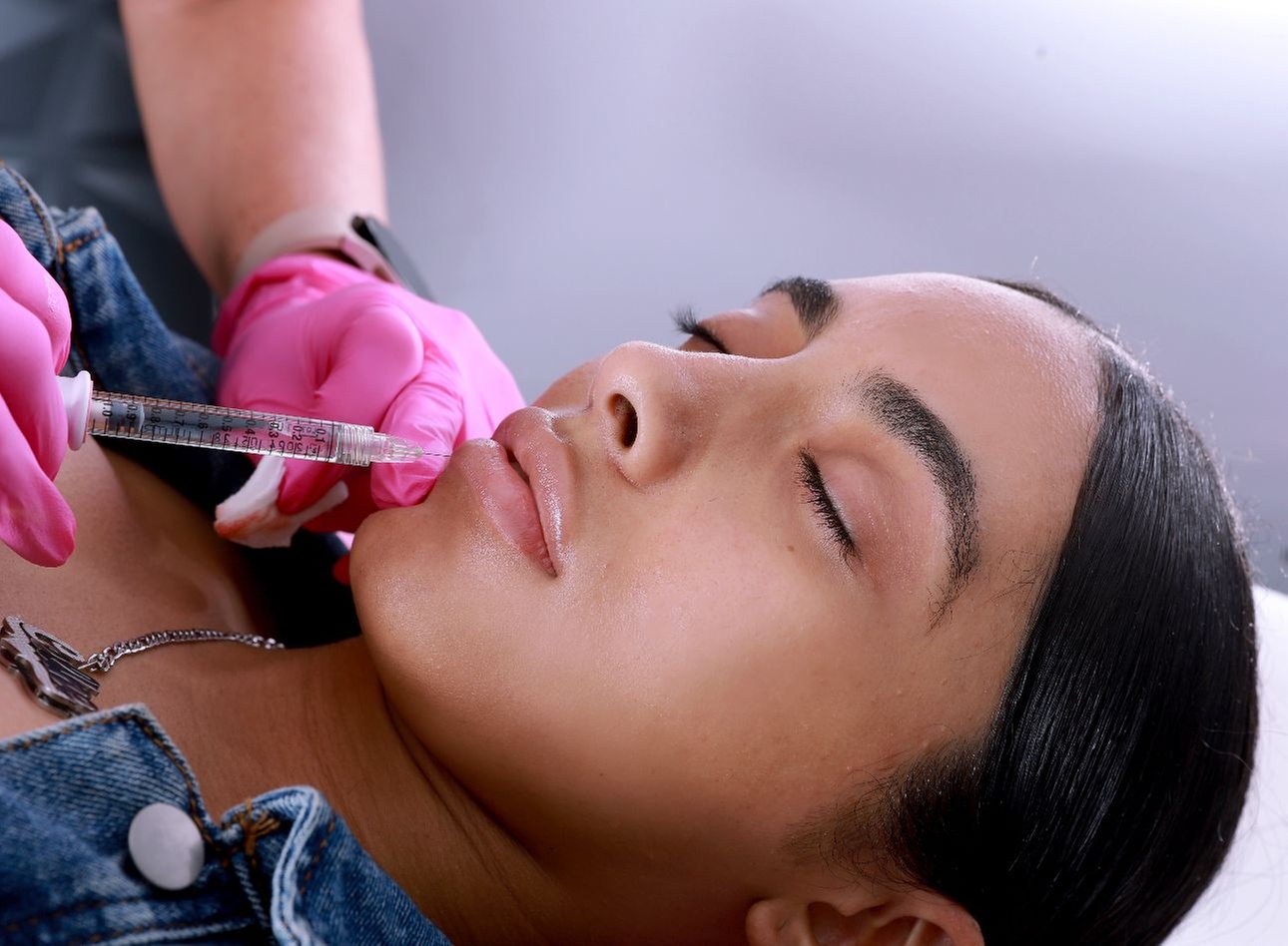 Transform with a Syringe of Versa, 3 or 4 Fillers, 1ml or 1ml of RHA