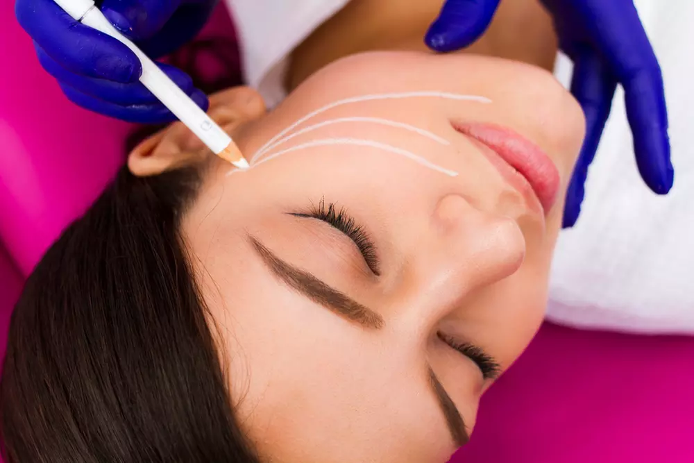 Revitalize with 10 PDO Thread Lifts for Mid-Face