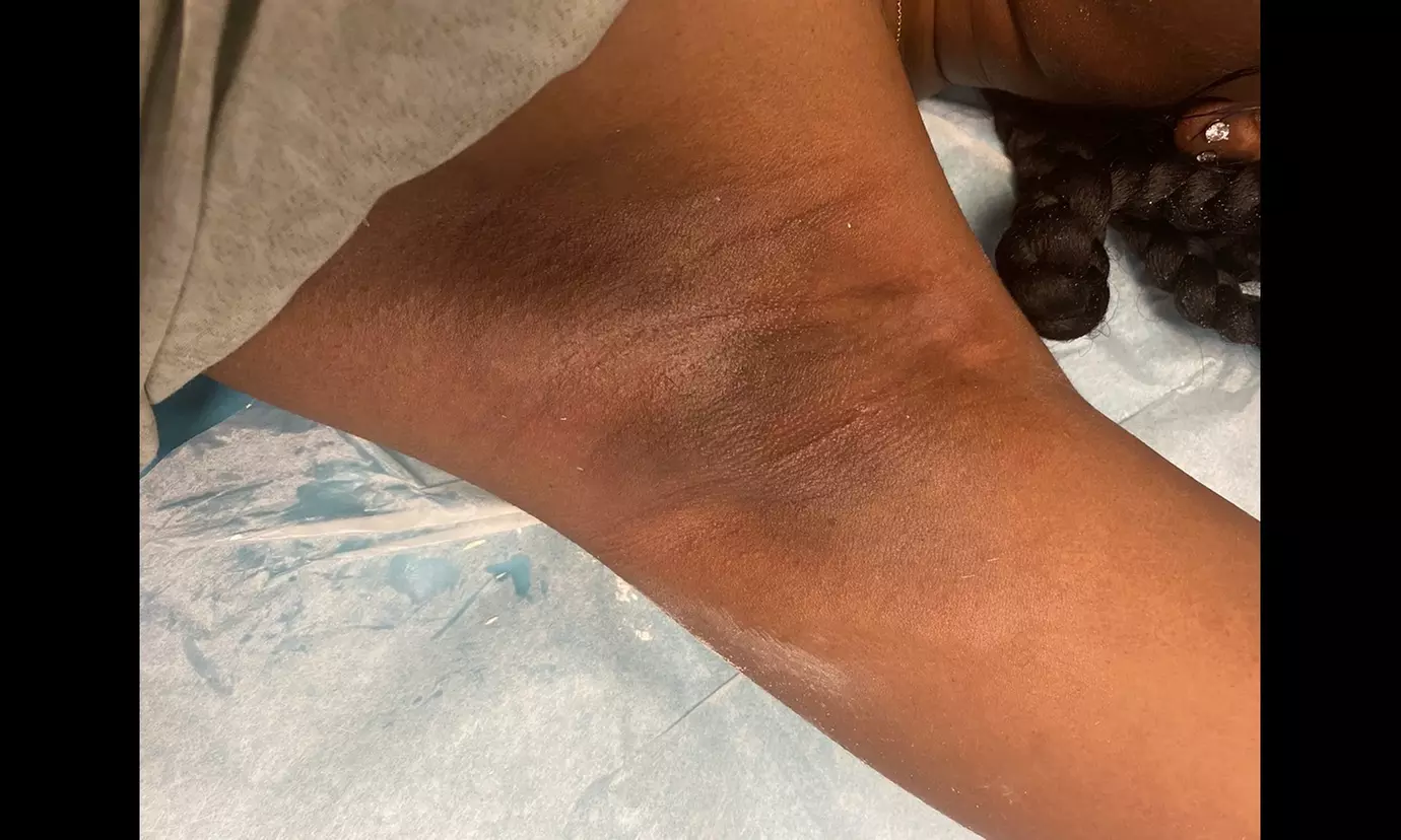 Get Smooth with Full Leg, Brazilian, or Lower Legs Wax Options
