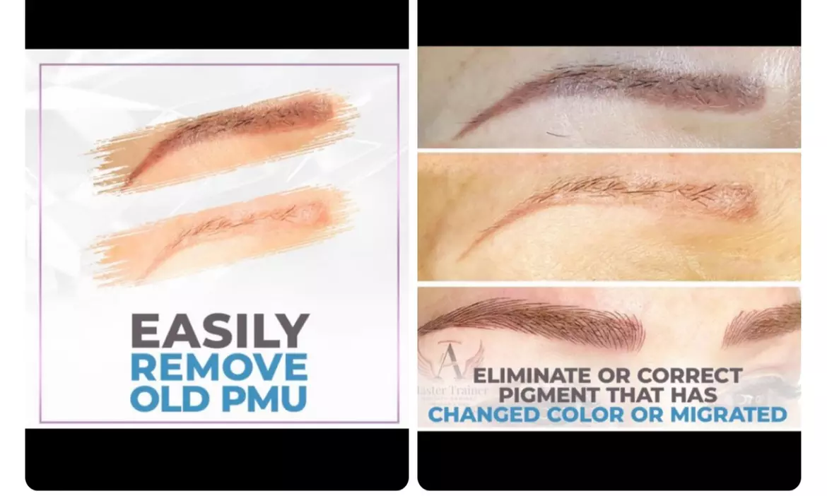 Up to 20% Off on Tattoo Removal at Aesthetic Brows_AM - Primary Image