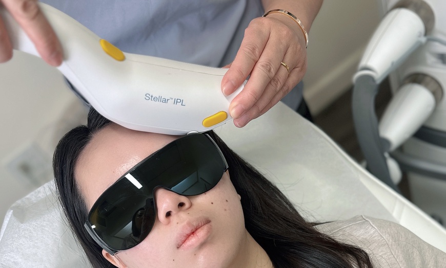 Image 2: One or Two Stellar M22 IPL Photofacial Treatments for Radiant Skin