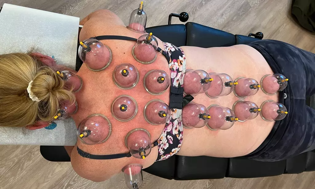 Up to 45% Off on Cupping at Wellness for Life - Primary Image