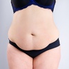 Image 1: Try Consultation with Lipo Laser Session Today