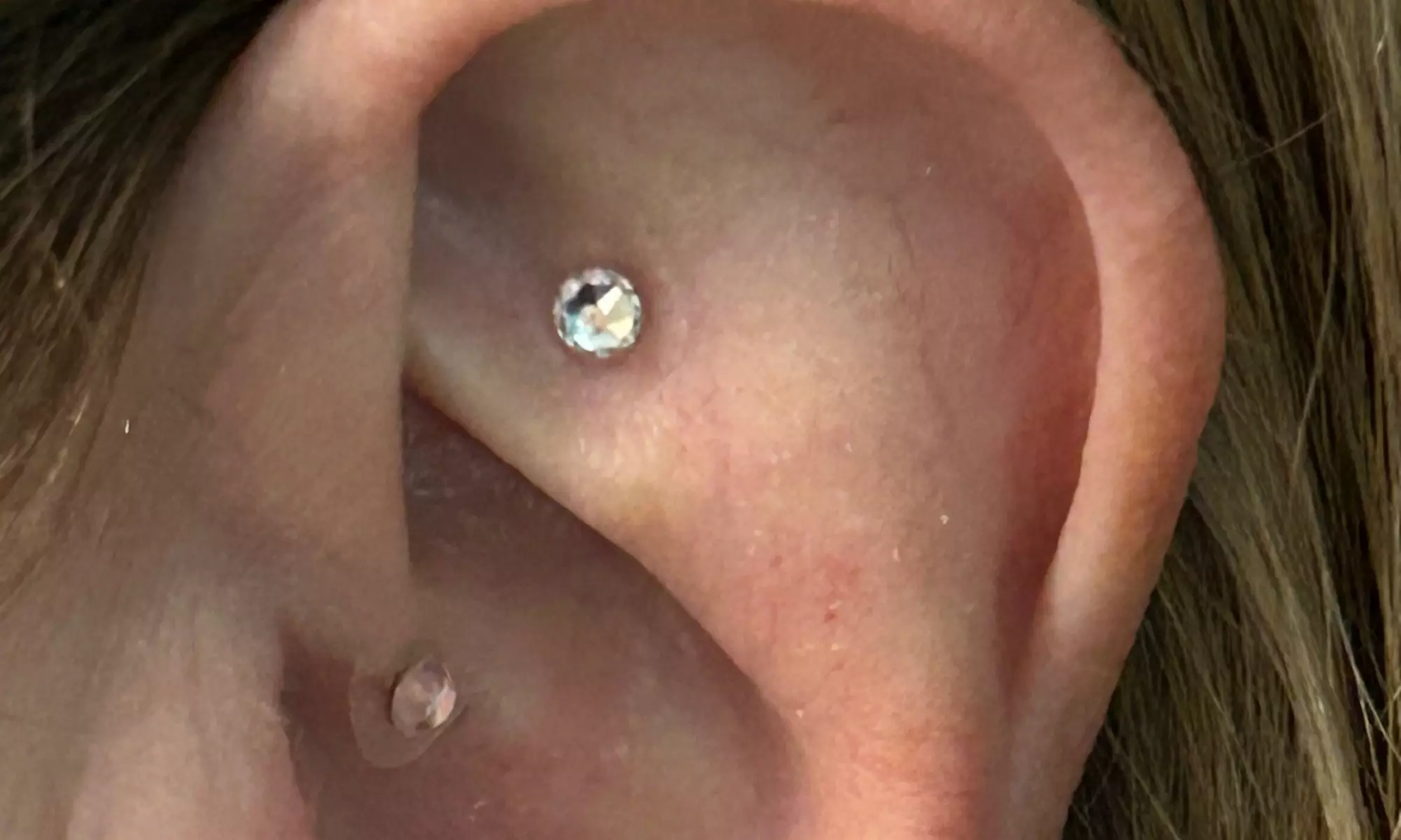 Discover Absolute Wellness Spa's ear acupuncture options with Swarovski crystals, silver, and gold pellets, saving up to 56% - Second Medium