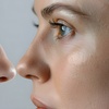 Image 8: Laser Skin Resurfacing Treatment at Rewind Medical Spa by Sharicom Health(Up to 30% Off)