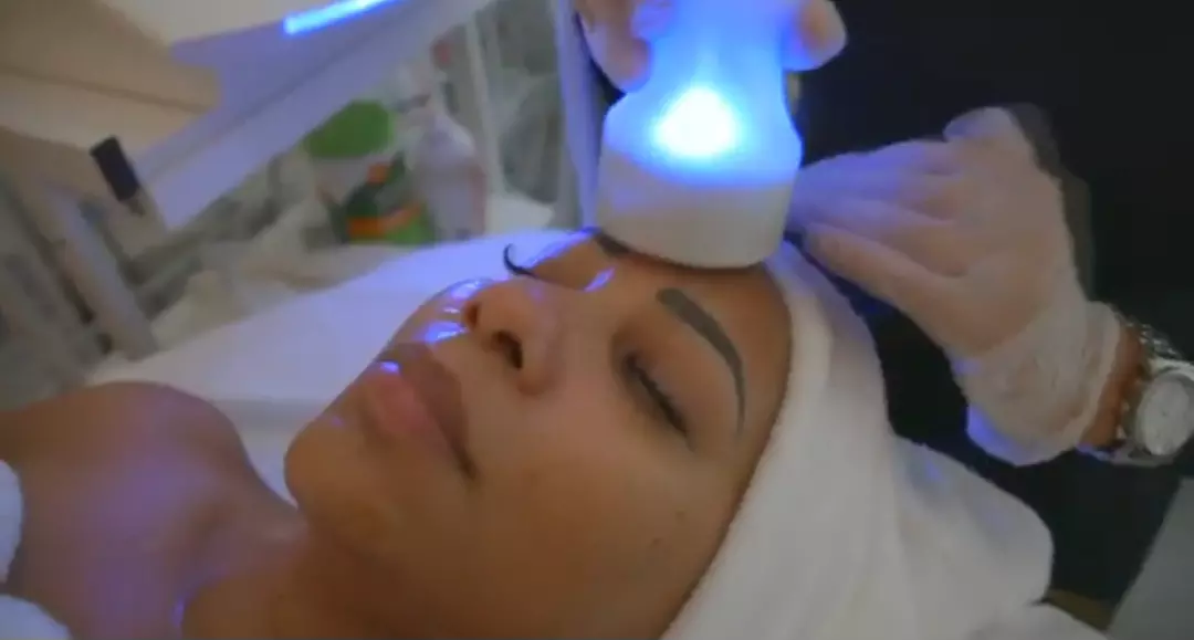 Up to 80% Off on CRYOSKIN Facelift/Facial treatment at Laser Loft Medspa Atlanta - Primary Image