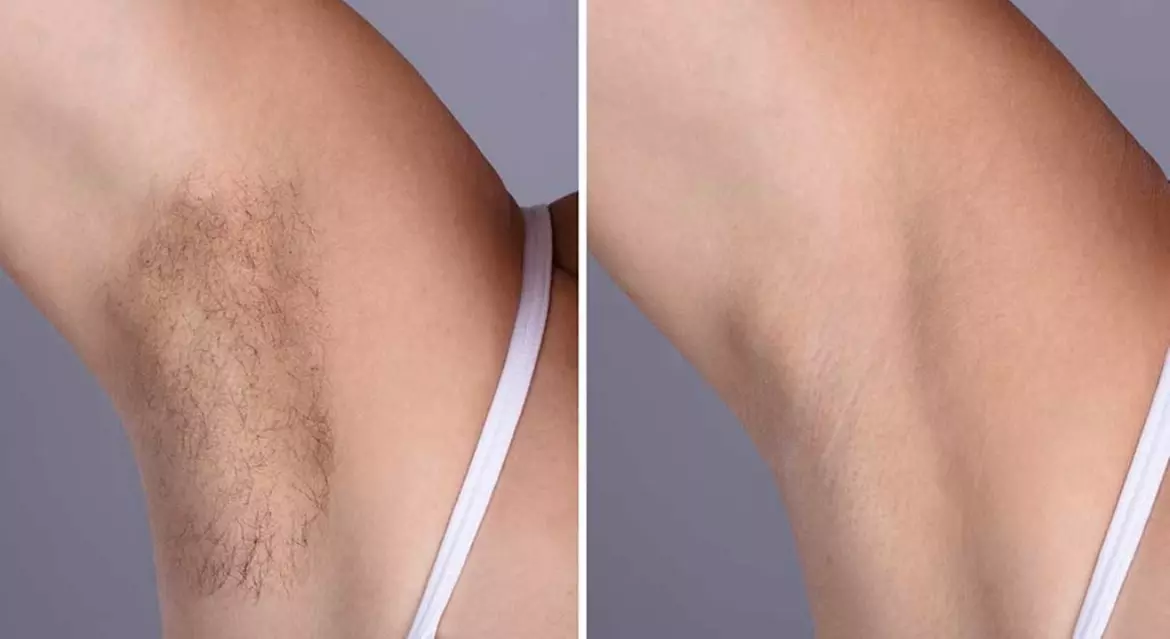 Up to 10% Off on Brazilian / Bikini Waxing at Proper Brows and Lash - Second Medium