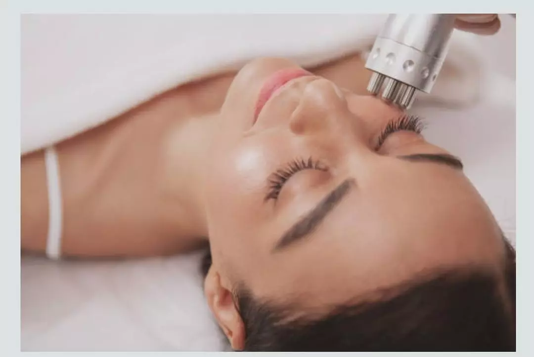 Up to 51% Off on Face Tightening Treatments at Yure Skinn & Body Lounge - Primary Image