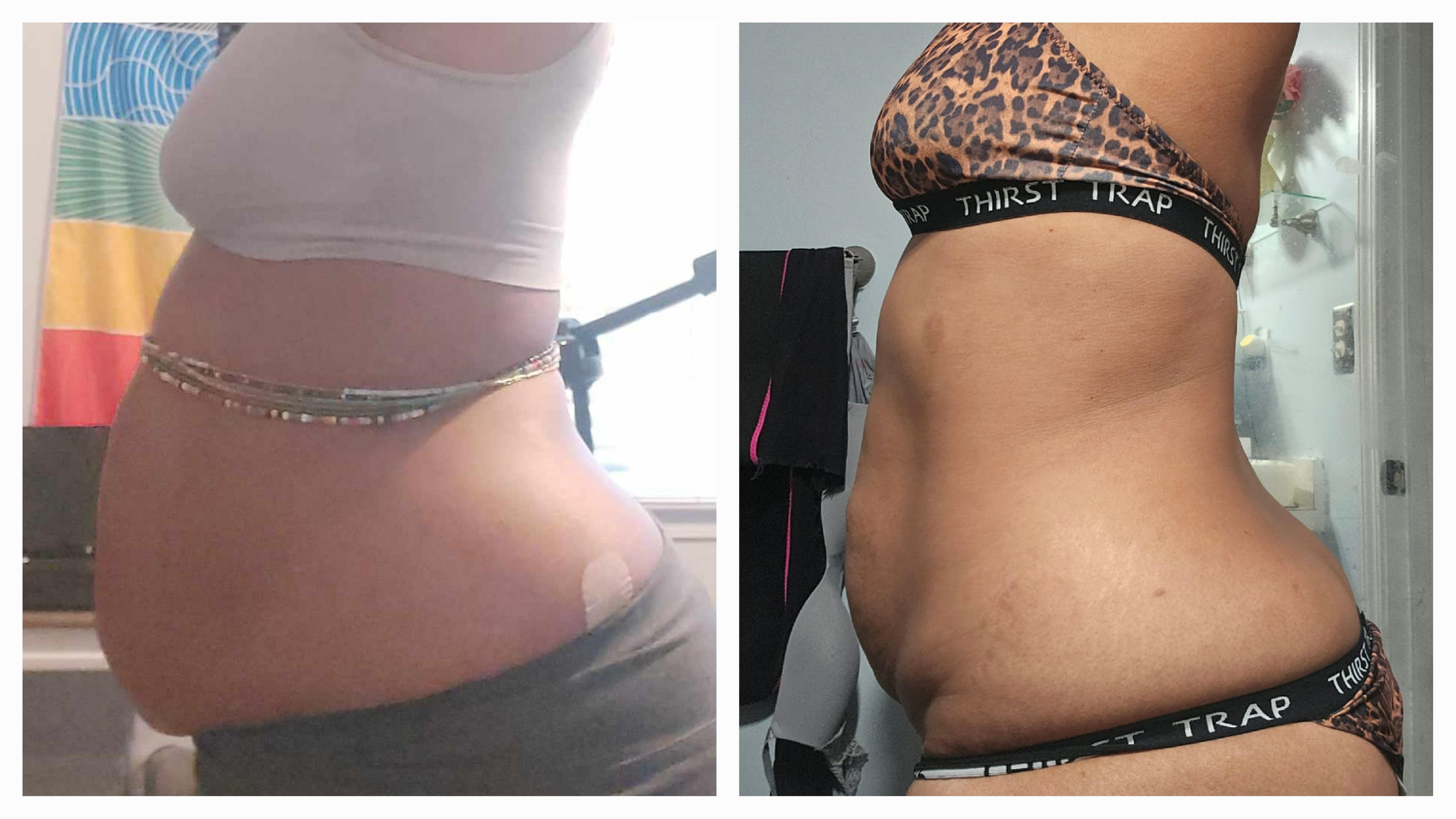 Up to 68% Off on Cavitation at Infallible Body Essentials LLC