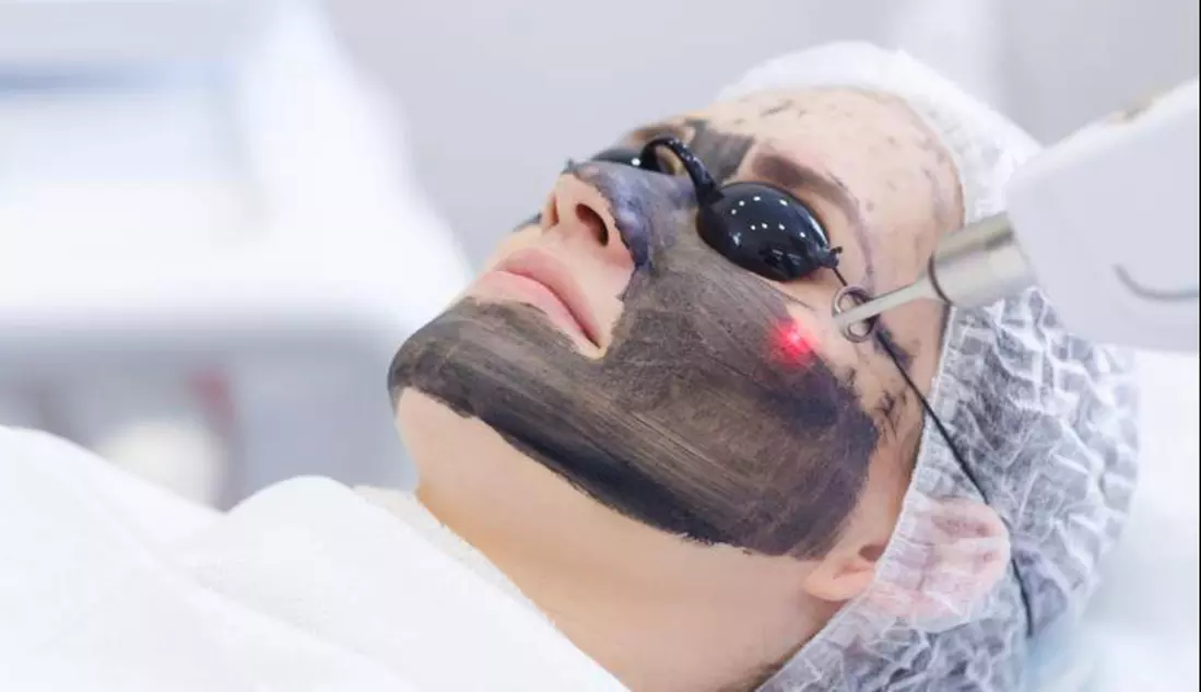 Up to 70% Off on IPL-Intense Pulse Light Therapy at X Beauty 29 - Primary Image