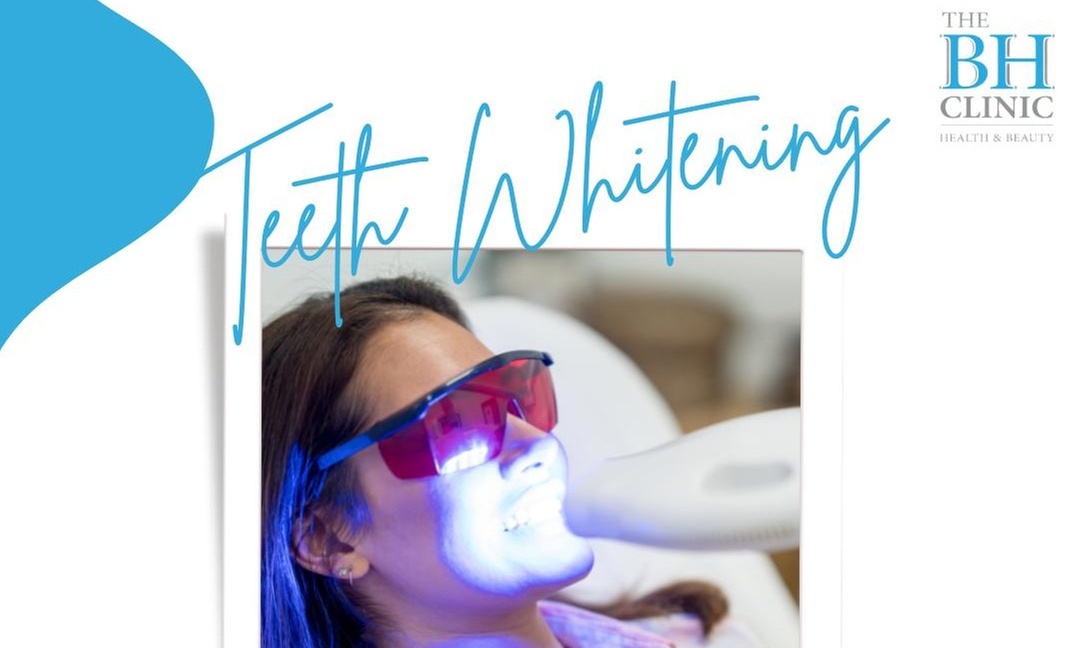 Laser Teeth Whitening for a Brighter Smile