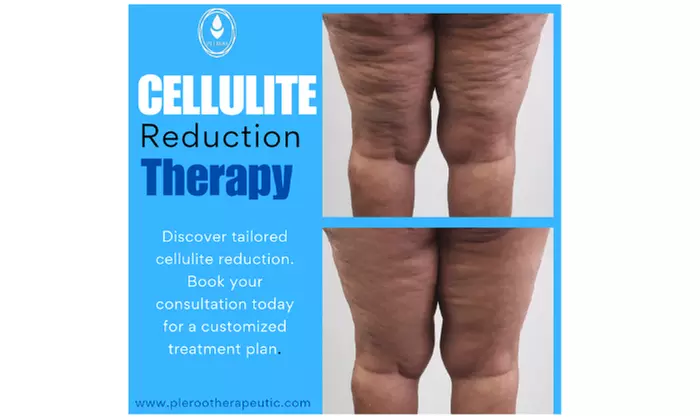 Up to 56% Off on Body Contouring at PLEROO Therapeutics