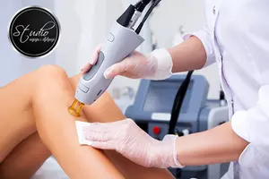 Pożegnaj pękające naczynka: zabieg laserowego zamykania naczynek na twarzy i ciele (do -50%)