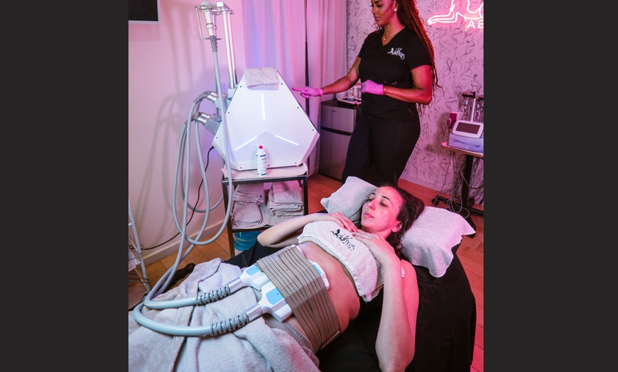 Image 1: Experience Fat Freezing & Wood Therapy Sessions Upto 57% Off. 