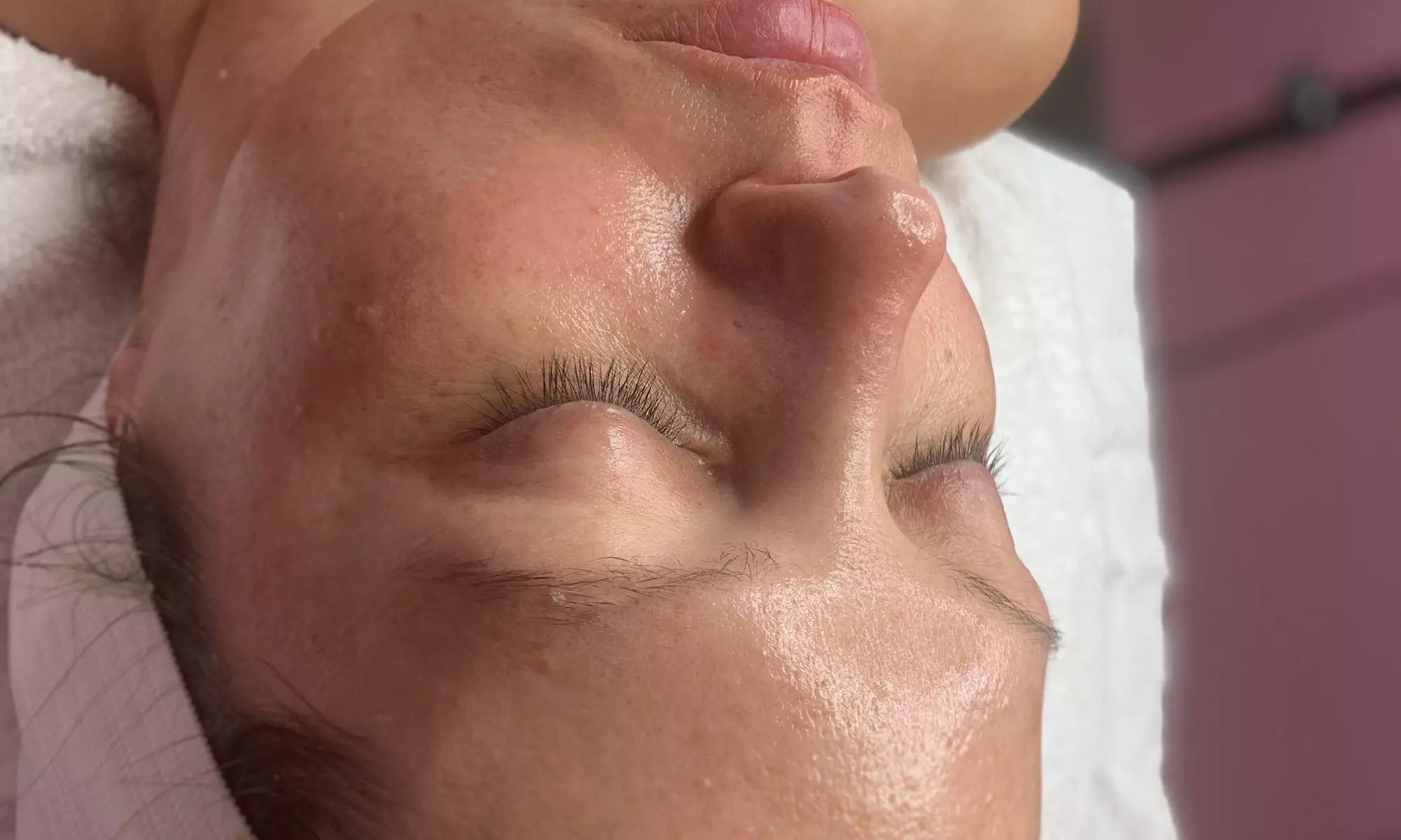 Up to 46% Off on Micro-Needling at Posh Body Lounge - Primary Image