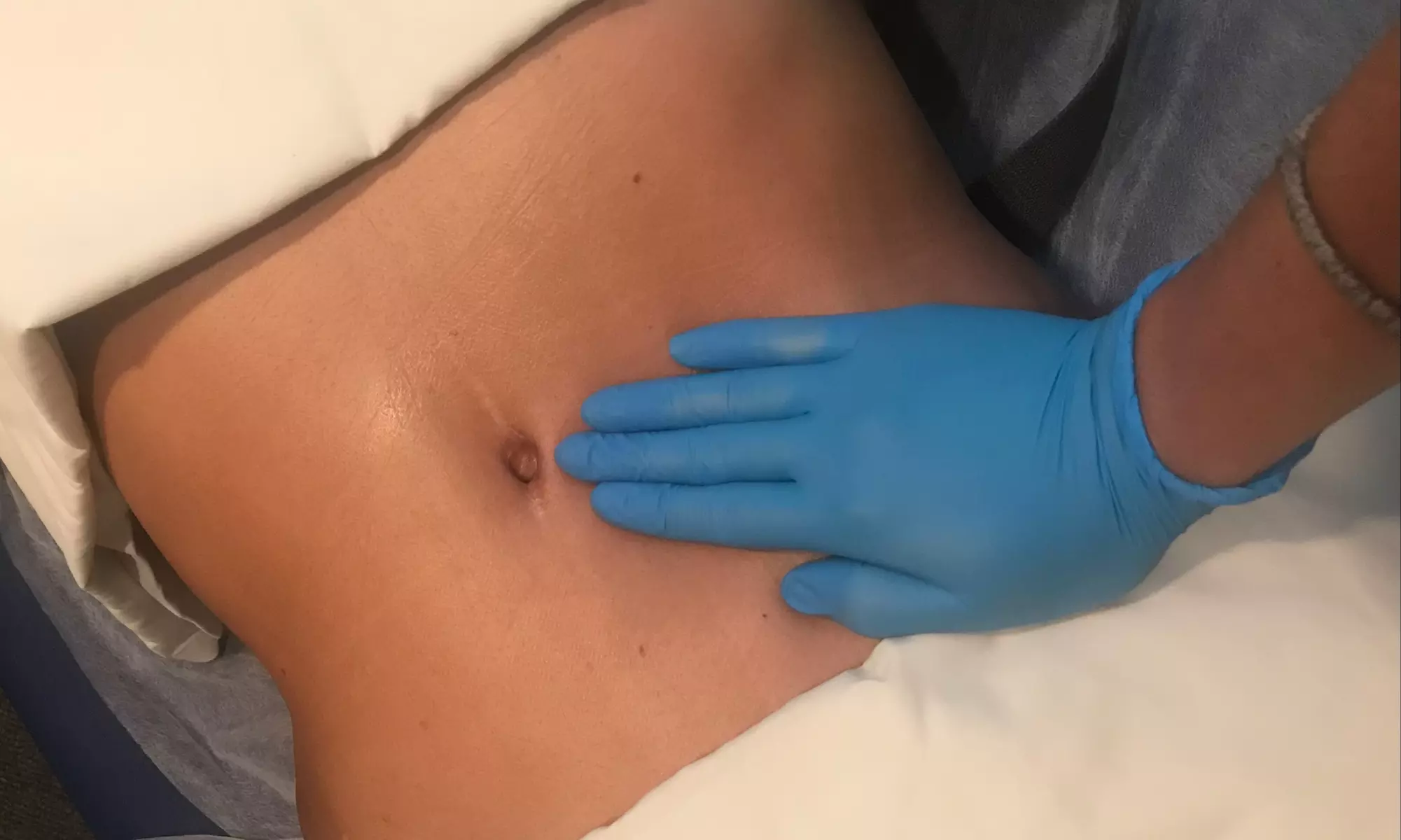 Experience up to 50% off at Saptherapy with tailored cupping and lymphatic therapy sessions, including consultations. - Primary Image