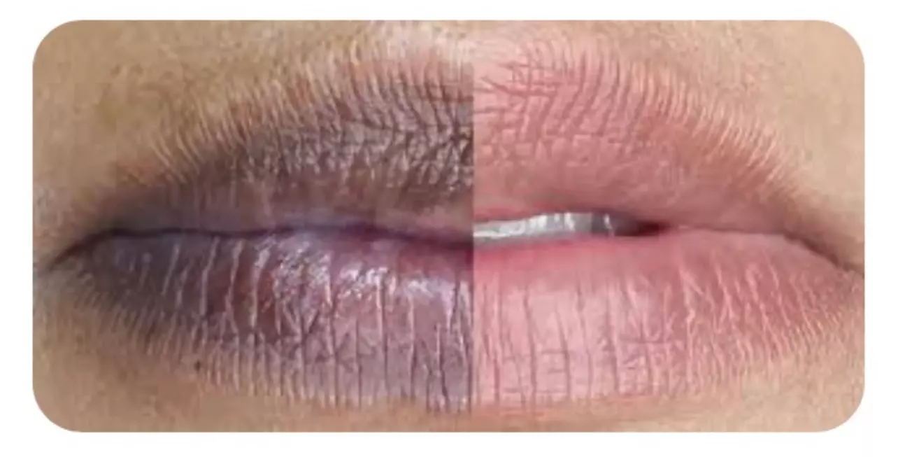 Up to 49% Off on Spa/Salon Beauty Treatments (Services)