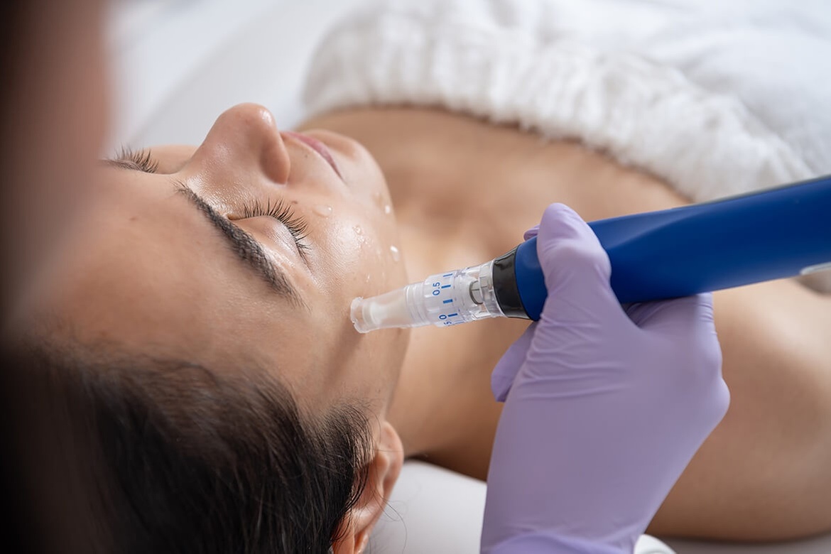 Revitalize Your Skin with Microneedling with Dermapen & High Frequency