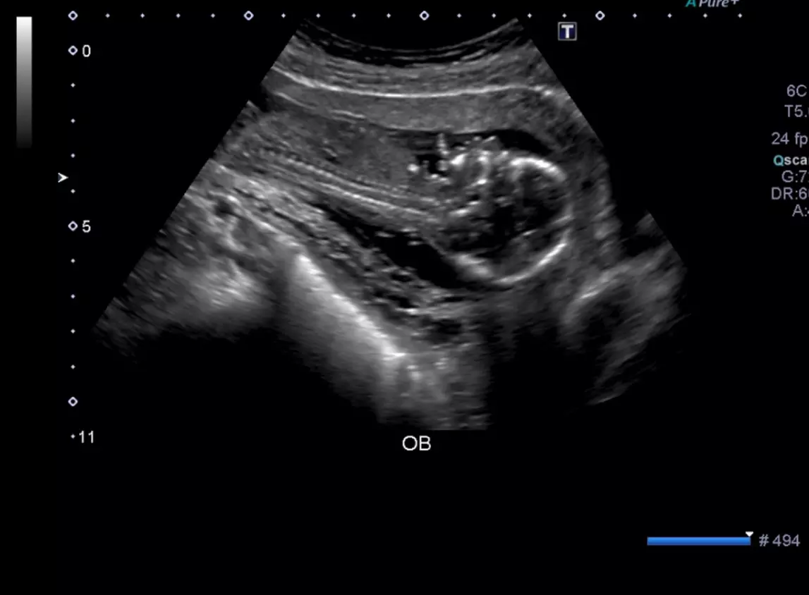 Up to 53% Off on Ultrasound at Luxury Therapy Medical Center - Second Medium