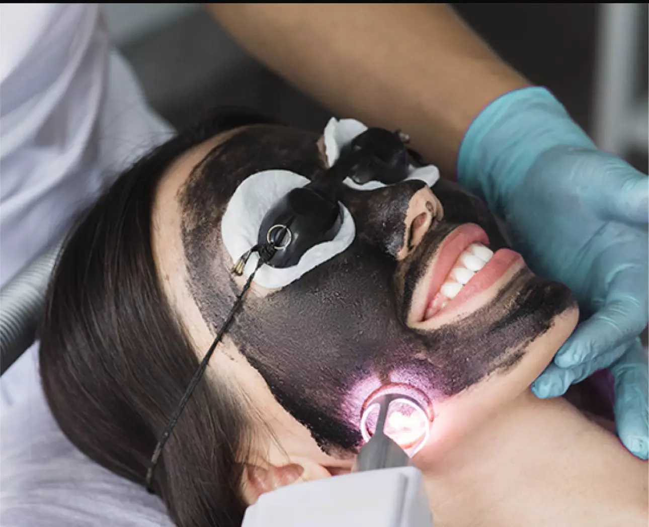 One Hollywood Carbon Peel Facials at Facials By Limary(Up to 53% Off) - Primary Image
